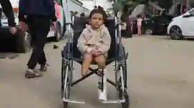 PBB Ungkap Fakta Menyedihkan: Satu dari Lima Orang yang Diamputasi di Gaza Adalah Anak-Anak