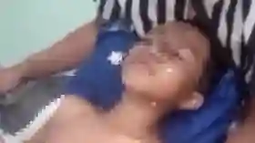 Sadis, 3 Santri di Lombok Dibakar Teman-1 Meninggal Dunia