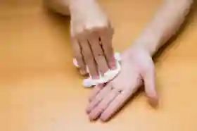 Mengenal Hiperhidrosis, Penyebab Tangan Sering Berkeringat yang Sering Disalahartikan
