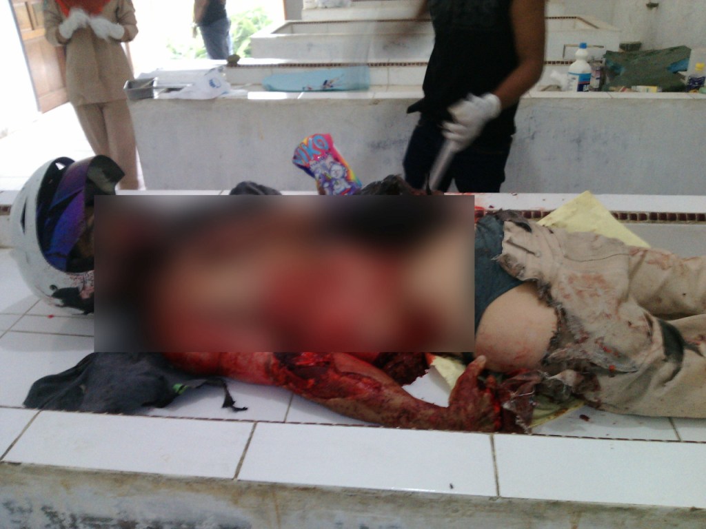 Terseret Truck Sejauh 50 M, Tubuh Pria di Bagan Batu ini Hancur | Peristiwa,